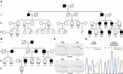A Novel Variant in the TBC1D24 Lipid-Binding Pocket Causes Autosomal Dominant Hearing Loss: Evidence for a Genotype-Phenotype Correlation